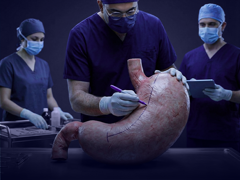 عمليات السمنة