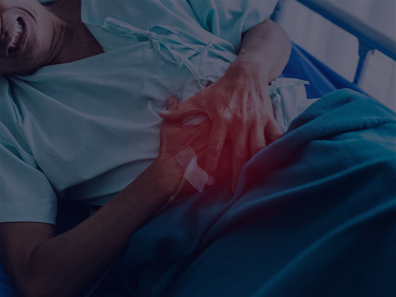 تكميم المعدة