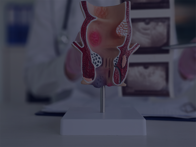 تصحيح جراحات السمنة