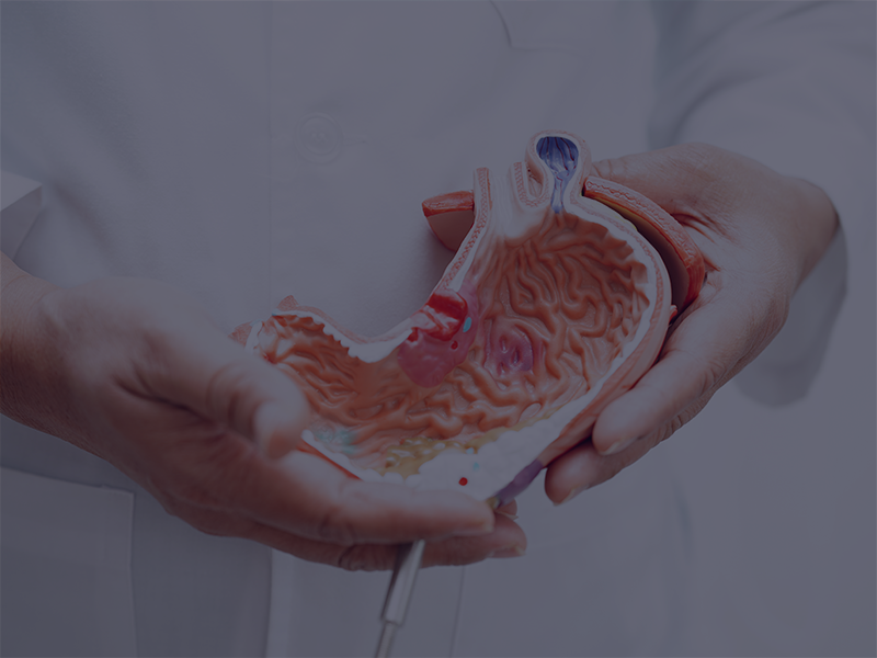 بالون المعدة