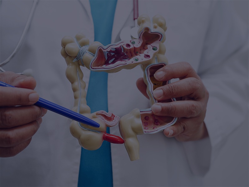 تحويل المسار