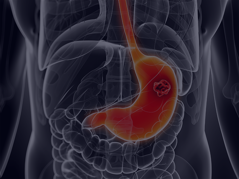 الساسي (التقسيم الثنائي)